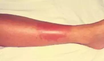 河北暴雨严重灾情，今天河北这22个地方可能发生崩塌