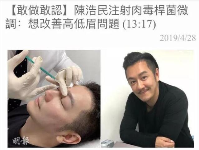 男星也微整？打玻尿酸、填充脂肪，有多少人假面且同化 娛樂八卦吃瓜 第8张
