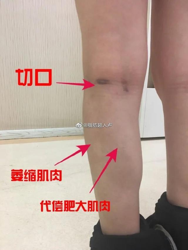 網紅式審美被噴上熱搜：這是自殘，不是性感 街拍正妹 第9张