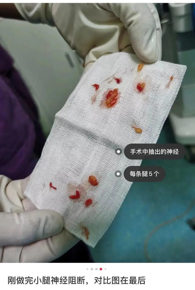 網紅式審美被噴上熱搜：這是自殘，不是性感 街拍正妹 第4张