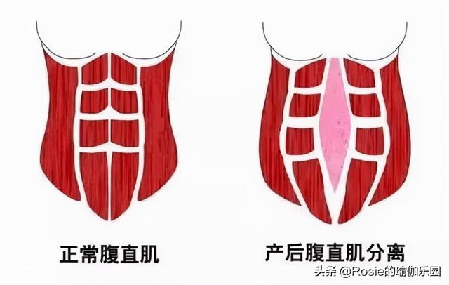 很瘦有肋骨外翻？堅持這4步纖腰平肋骨，解鎖金晨性感身材 健身減肥達人 第17张
