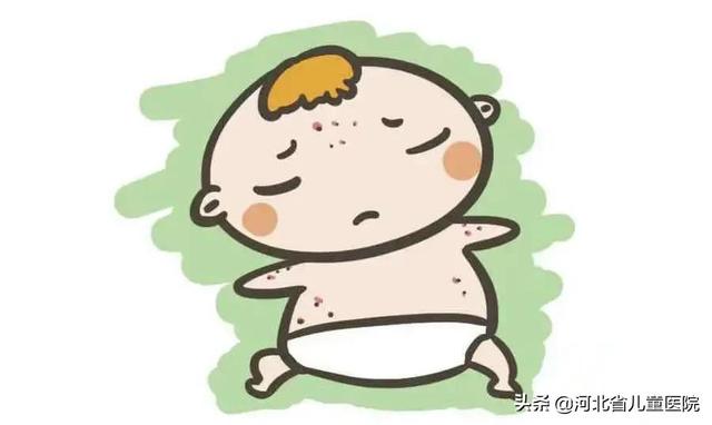 小孩出疹子图片，小孩疹子的种类及症状