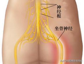 6個動作，緩解坐骨神經痛，腰不疼了腿也不麻了，效果槓槓滴 健身減肥達人 第2张