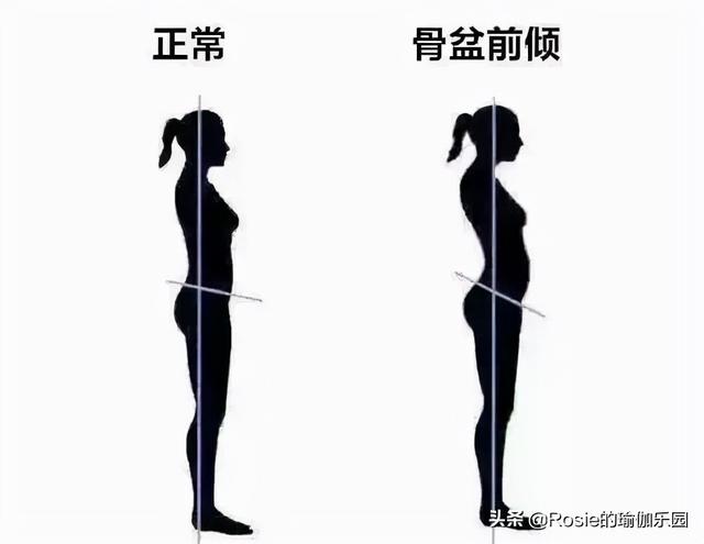 腿精唐嫣美人魚造型太驚艷，如何改善O腿變細直？4個動作帶你練 健身減肥達人 第19张
