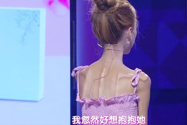百萬粉絲網紅暴瘦，皮包骨頭全脫相，娛樂圈明星過度減肥不可取 娛樂八卦吃瓜 第9张