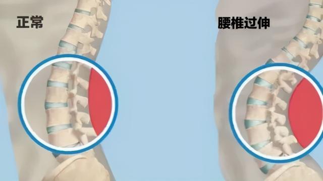 「漫畫腰」挑戰被女生玩壞了，這不是性感，是有病 街拍正妹 第13张