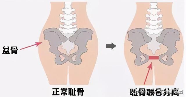 朱珠曬孕照優雅美麗，產後如何擺脫媽媽臀？關注這三點臀翹不腰痛 健身減肥達人 第12张