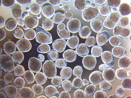 Nature“ viewpoint: how stem cells repair type 1 |