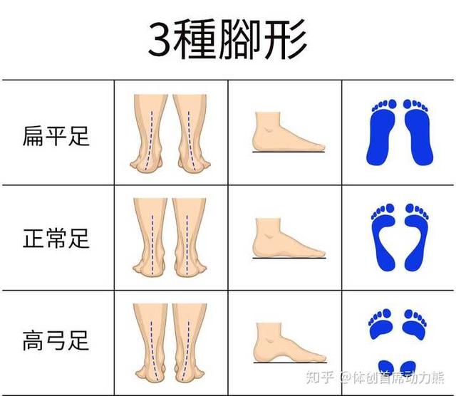 足底疼痛位置图，脚底疼痛部位图解（足跟痛是什么？要怎样预防）