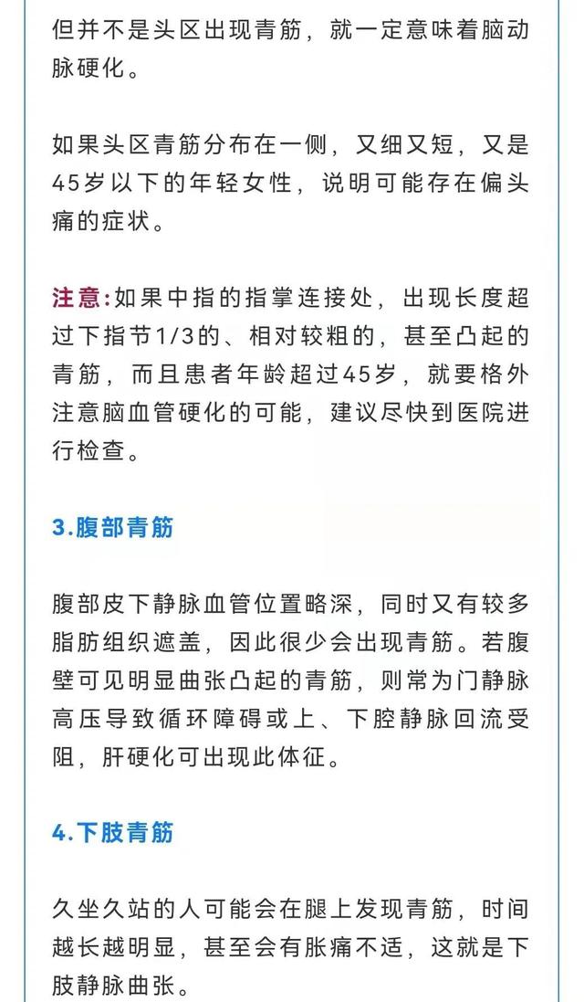 做梦开车撞死人(做梦开车撞死人了是什么征兆)插图3