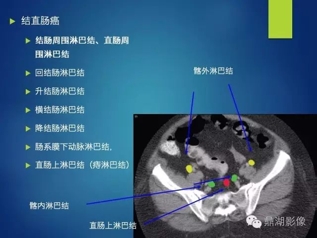 腹部淋巴结腹部淋巴结发炎引起腹痛如何缓解