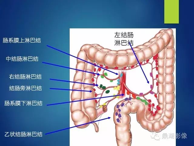 腹部淋巴结腹部淋巴结发炎引起腹痛如何缓解