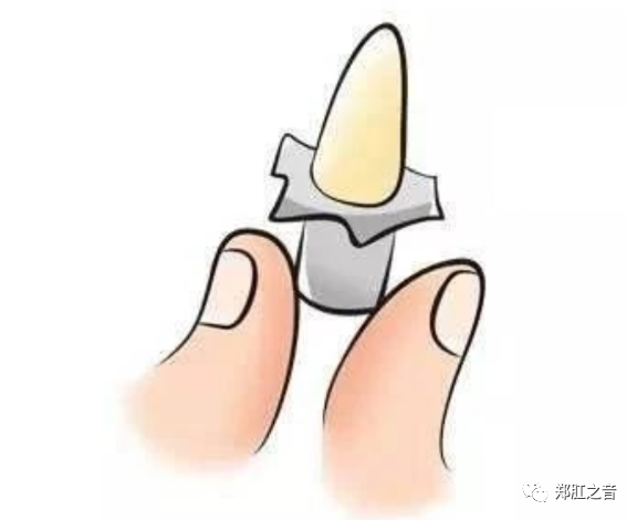 肛肠疾病不用怕，中医治疗有一套！——外治法