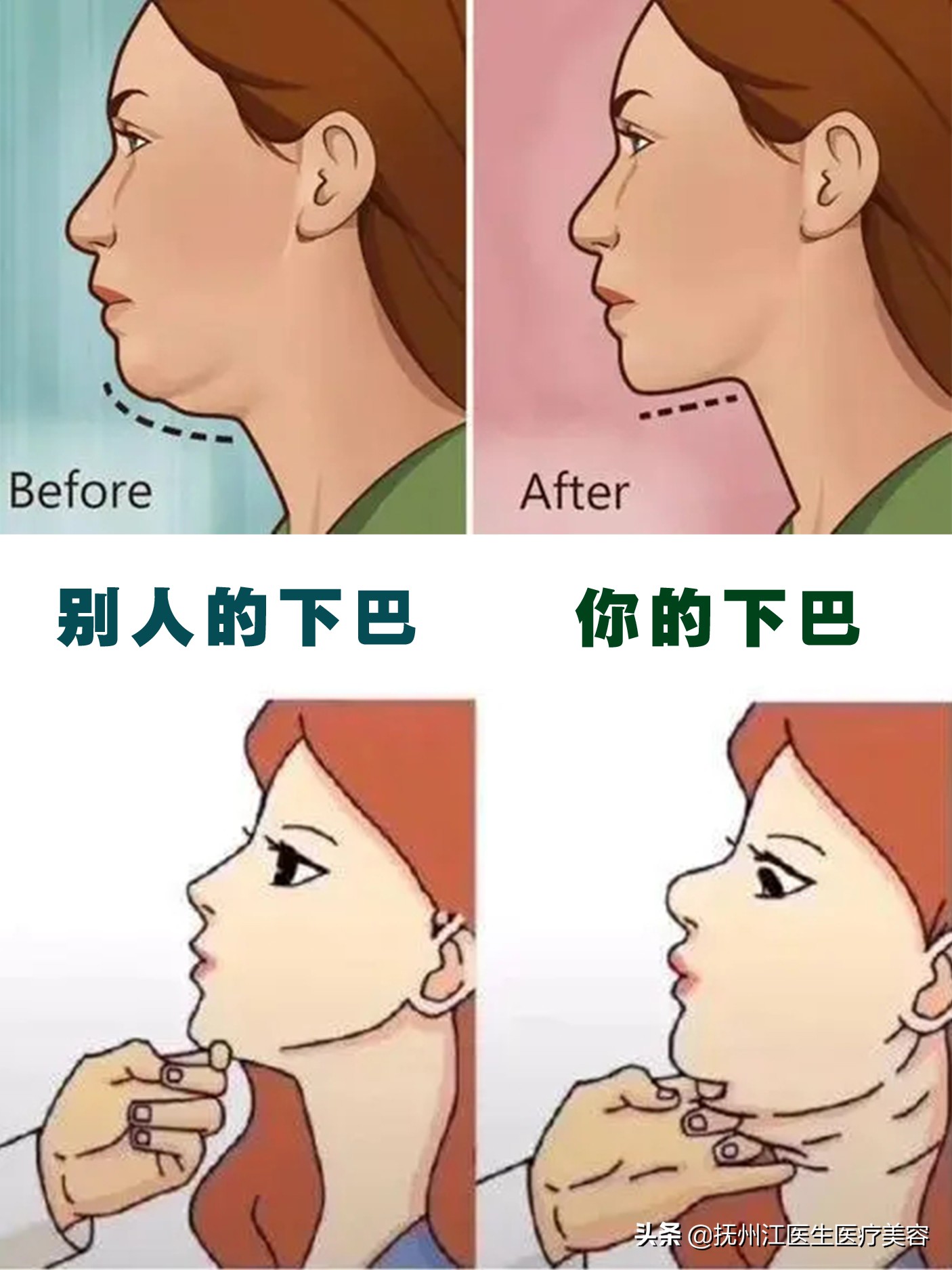 消灭双下巴!养成侧颜杀