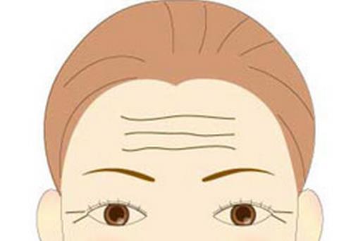 抬头纹面相分析(抬头纹面相图解女)-寅森速头条