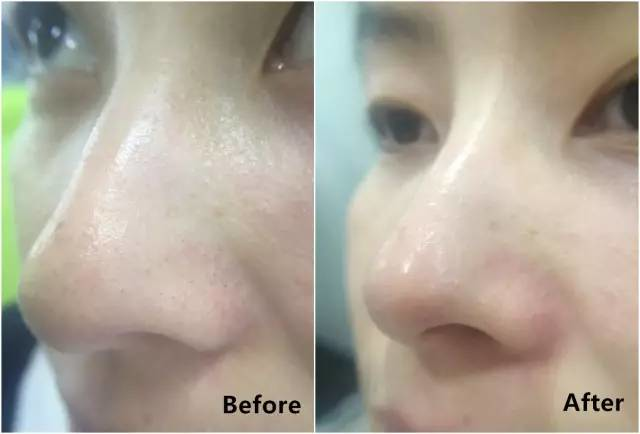 悦诗风吟火山泥面膜，悦诗风吟火山泥面膜多久用一次（亲测8款网红清洁泥膜）