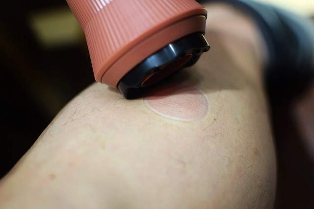 养生利器 左点智能走罐刮痧器