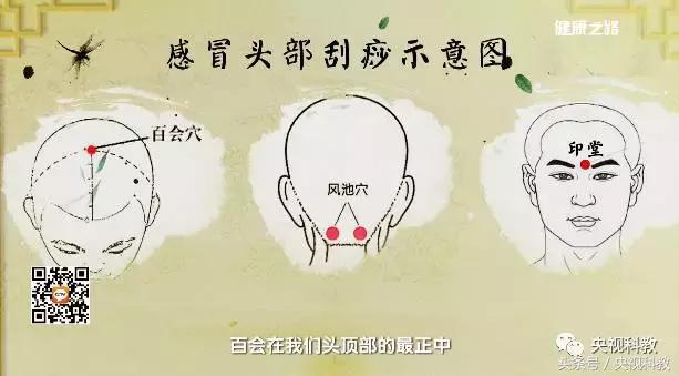 刮痧之后可以涂抹身体乳吗