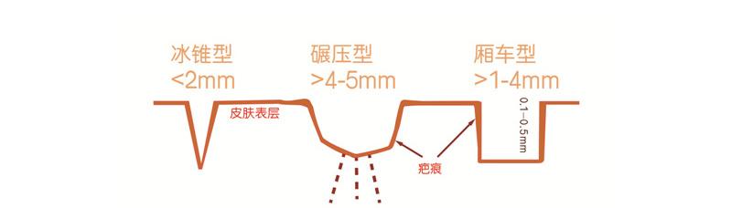 「良心功课」痘印，痘坑，毛孔粗大