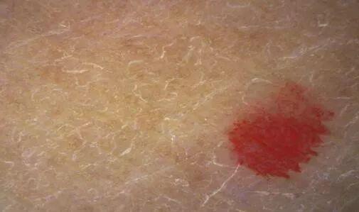 身体乳二氧化钛