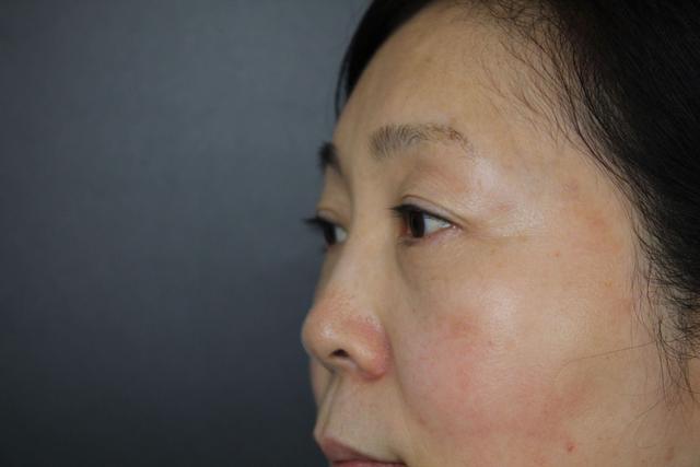 脸上有这3种“丑态”的人，多半都是肝脏病变了，劝你尽早重视