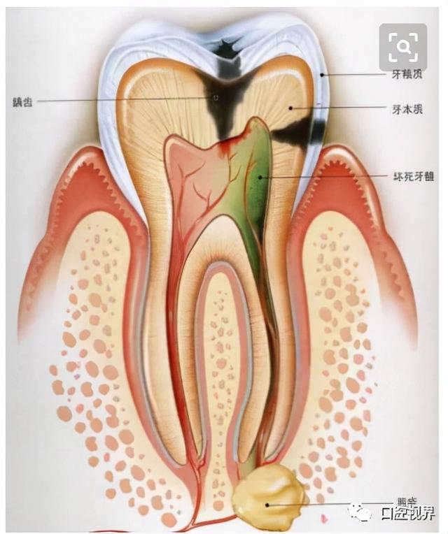 孩子拍牙片会损伤智商？真相是？