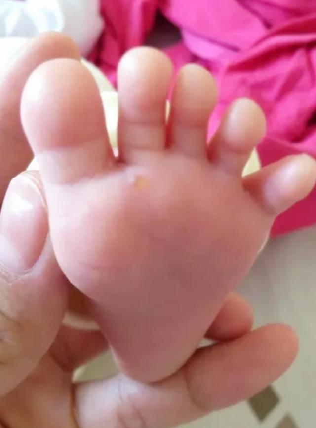 孩子再喜欢这种鞋，妈妈也要尽量避免购买，潜藏的危害很大