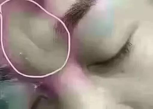 怎么去掉悬针纹小妙招（悬针纹怎么形成的）