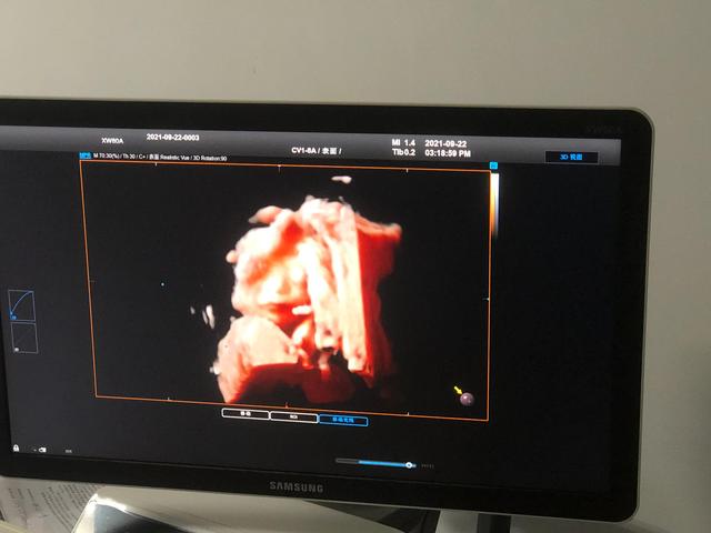 预产期2022.1.19有同一天的吗