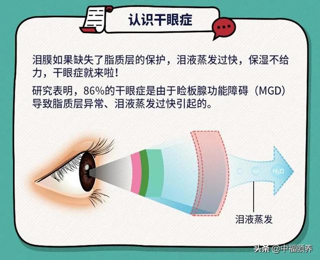 关注眼部健康，别让干眼症找上门