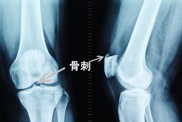 医生提醒：这5种疾病，或只能控制病情，无法根治，请理性对待