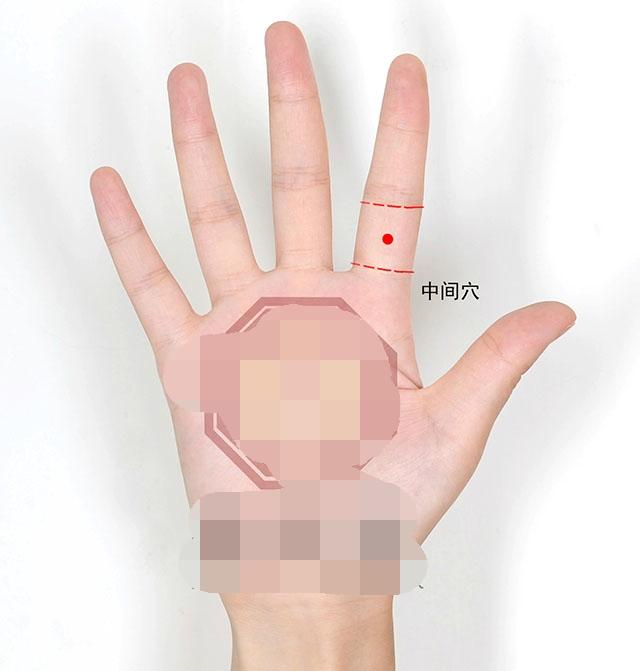 中医针灸治疗眼睛疾病配穴处方6