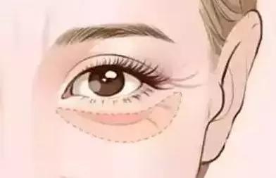 汗孔角化症能治愈吗