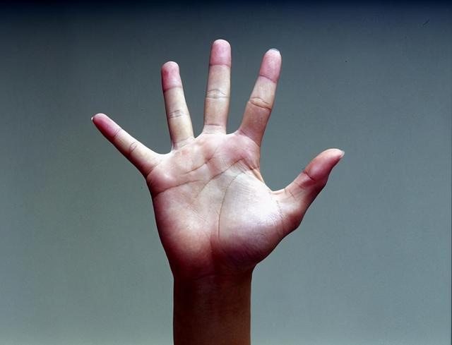 手脱皮怎么治疗好（手上老是脱皮怎么办）