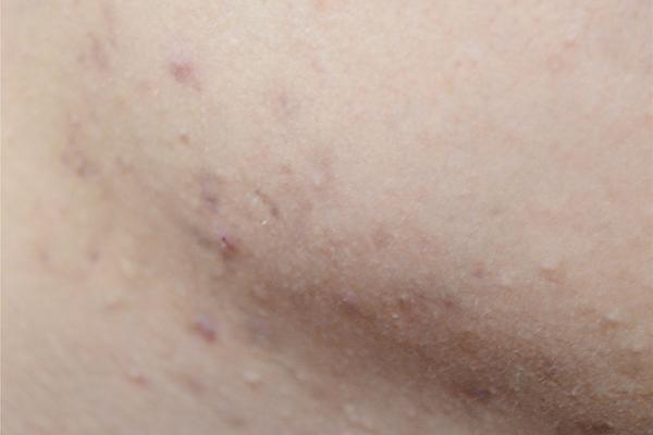 既怕冷又上火，“上热下寒”体质的人，该如何调理？本文给您建议