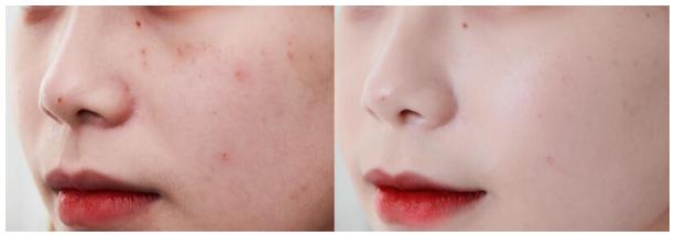 雏菊的天空身体乳祛痘