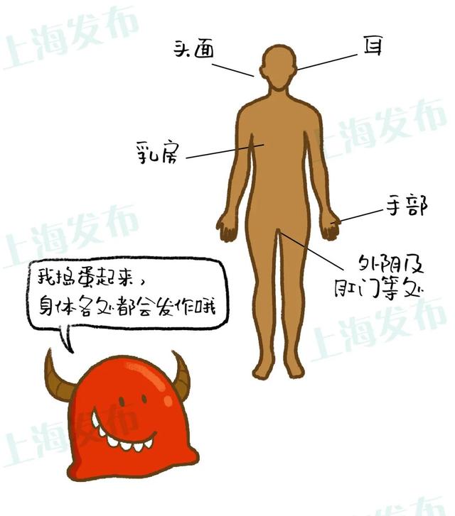 湿疹是否需要多擦身体乳