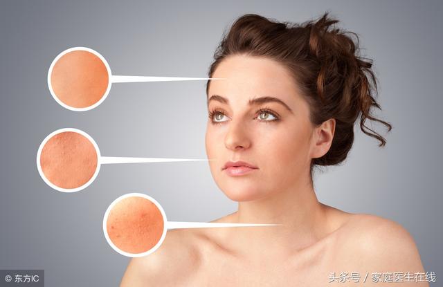 脸上总长粉刺怎么办