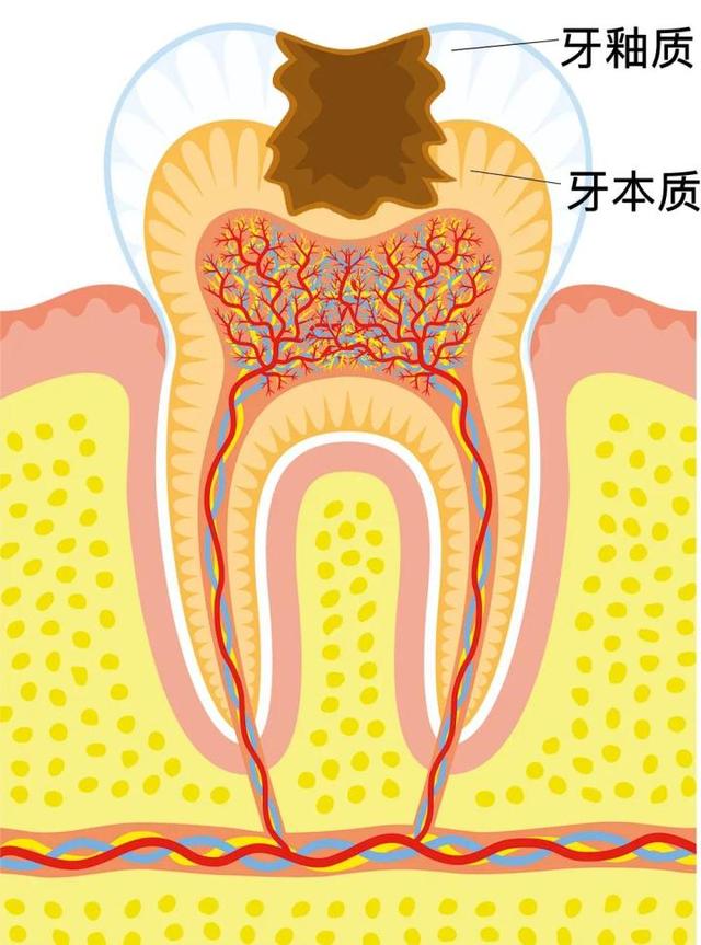 生命滙马泷齿科｜乳牙蛀牙需要及时补吗？