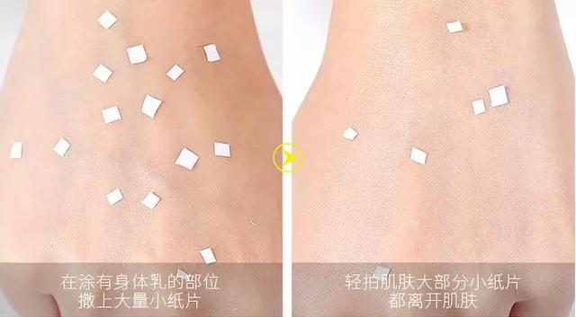 冬天局部皮肤瘙痒鸡皮