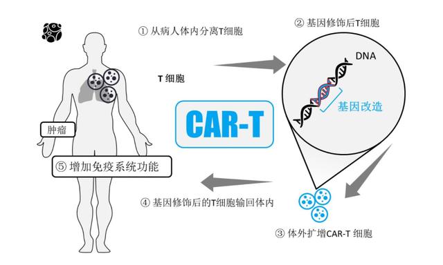 一针或可杀死癌症 中国抗癌药新突破 首款car T细胞疗法上市 今日热点