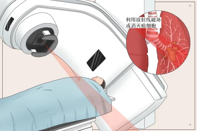 為了清除體內的癌細胞，我接受了化療，為了活下去，我放棄了化療
