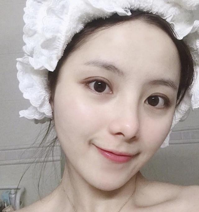 维a酸乳膏可以去除鸡皮肤吗