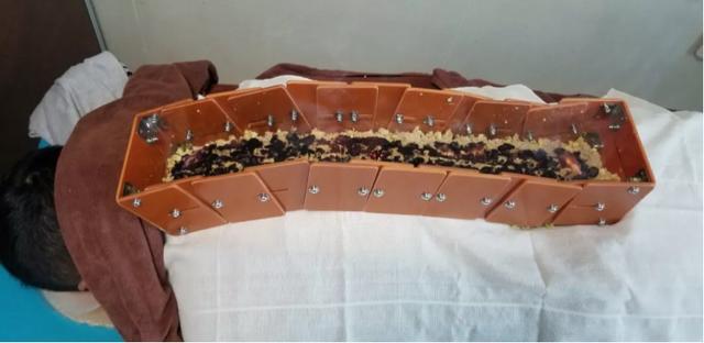 您是哪种感冒？对症治疗很重要