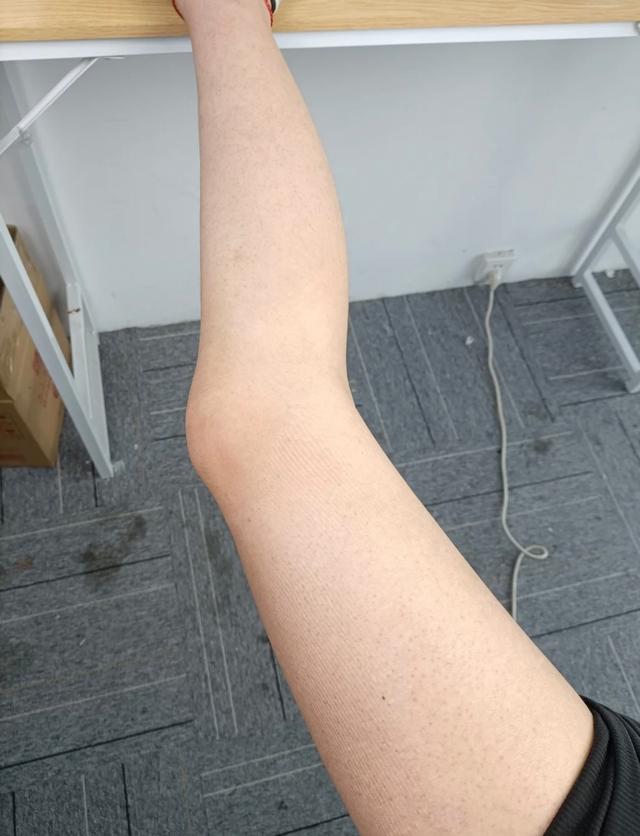 鸡肉的鸡皮会对皮肤好吗