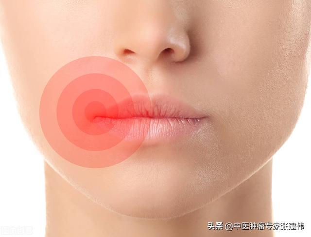 通過嘴唇顏色來“辨別”健康，快看看你的唇色是否健康