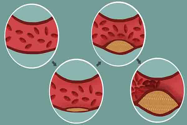 每天坚持喝绿茶，对身体有四大好处，但有“3不宜”，喝错反伤身