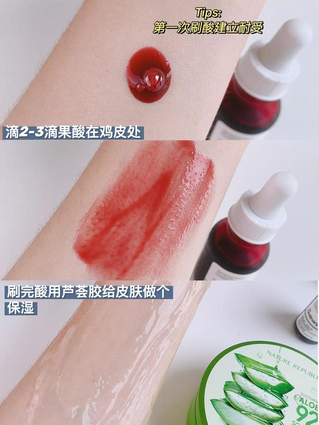 芦荟胶涂腿上可以去鸡皮疙瘩吗