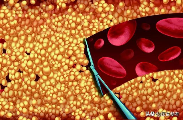 这些现象提示你的血脂可能高了，营养师盘点10大降血脂食物