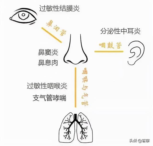 季节感受器——过敏性鼻炎，强冷空气来之前的自我调治与护理